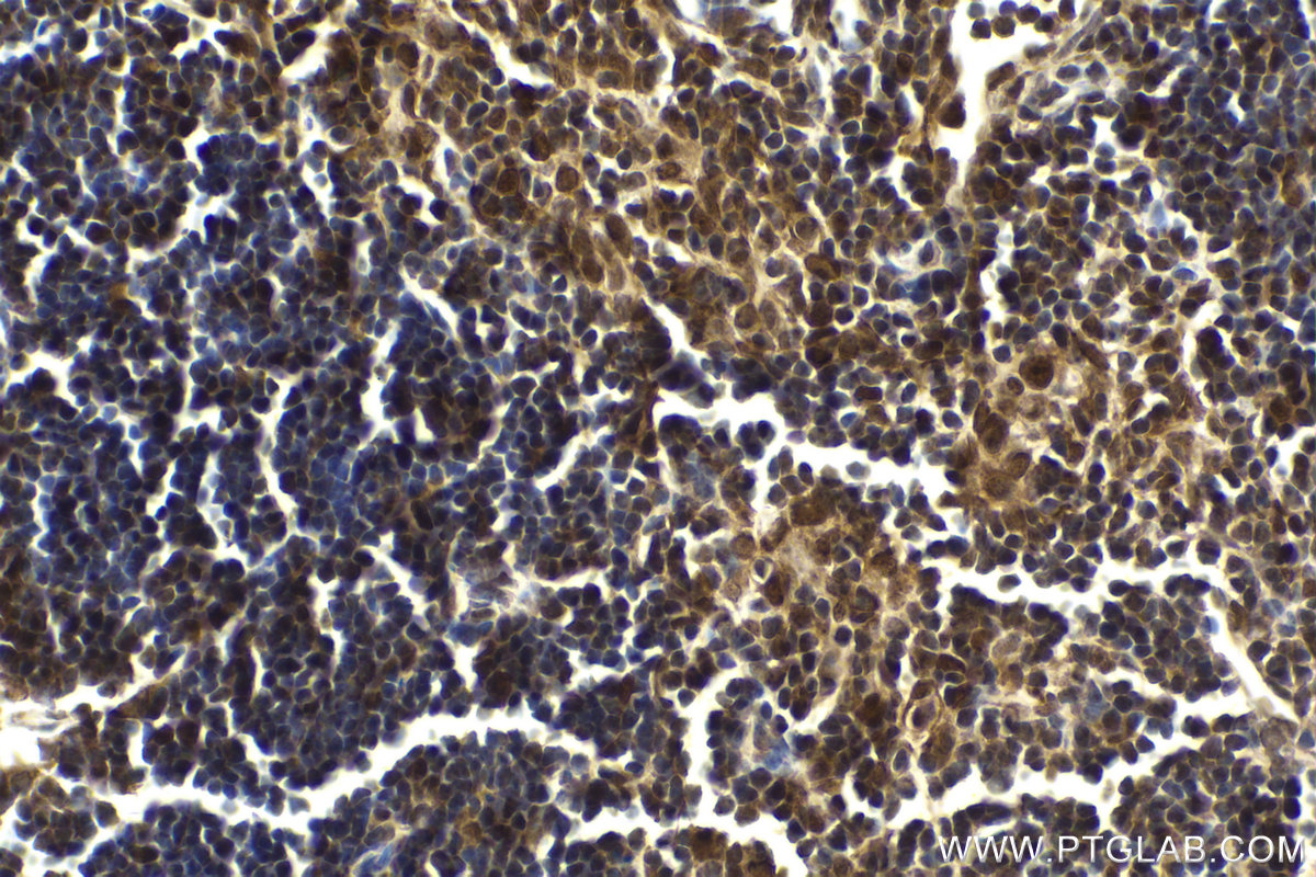 Immunohistochemical analysis of paraffin-embedded mouse thymus tissue slide using KHC2127 (RECQL4 IHC Kit).