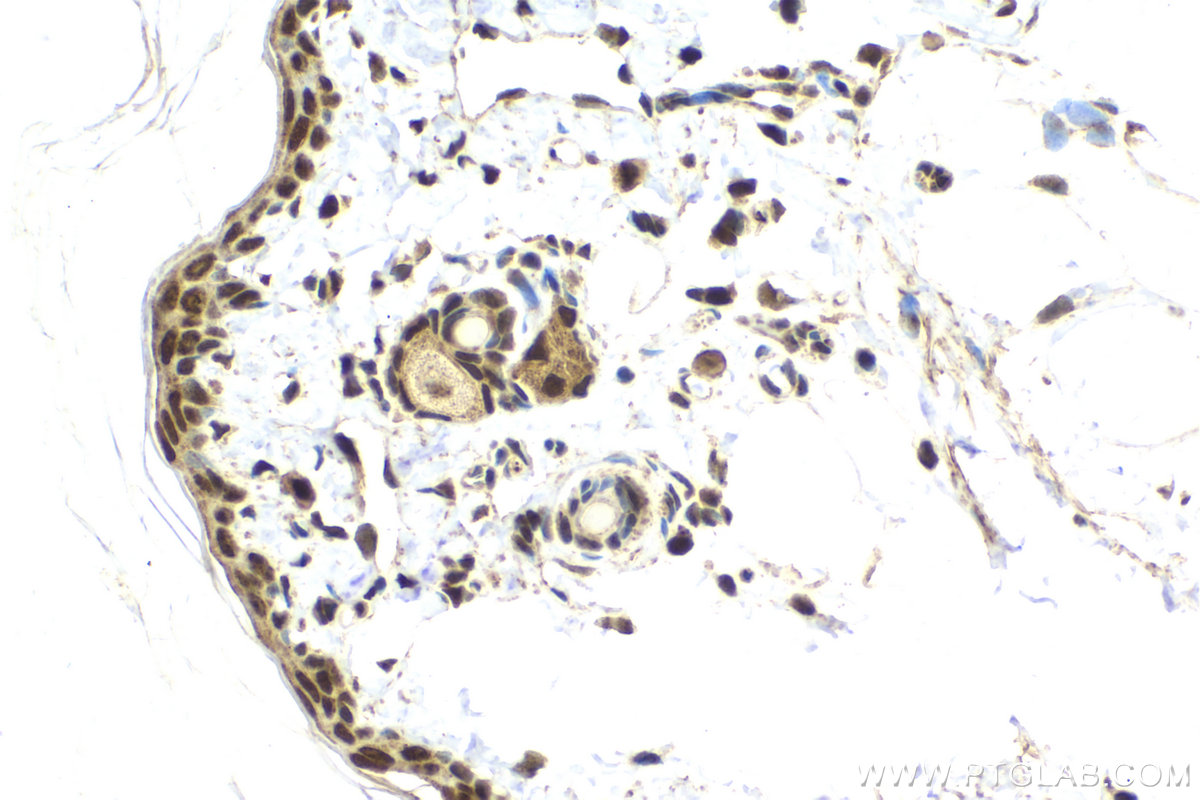 Immunohistochemical analysis of paraffin-embedded rat skin tissue slide using KHC2128 (RECQL5 IHC Kit).
