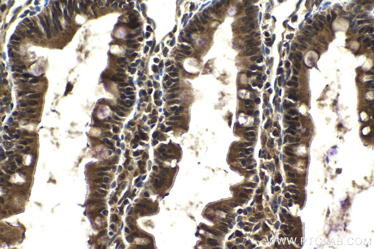 Immunohistochemical analysis of paraffin-embedded rat small intestine tissue slide using KHC2128 (RECQL5 IHC Kit).