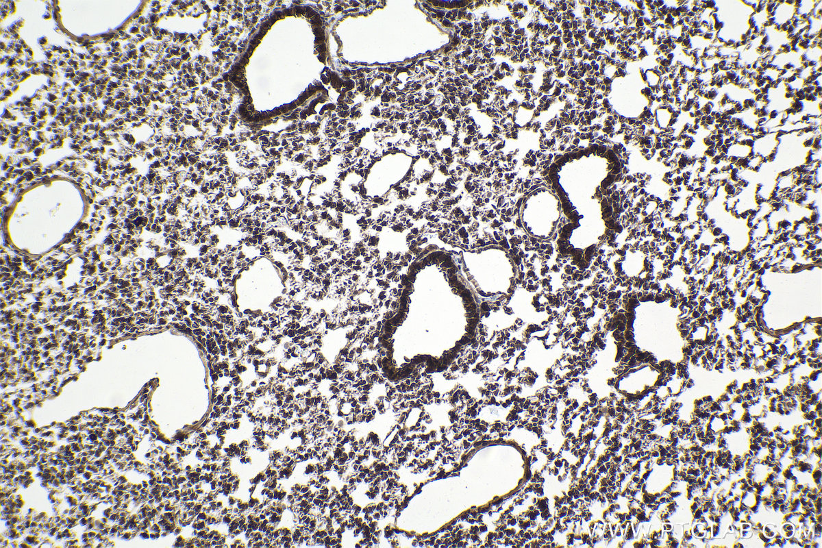 Immunohistochemical analysis of paraffin-embedded mouse lung tissue slide using KHC1933 (RGC32 IHC Kit).
