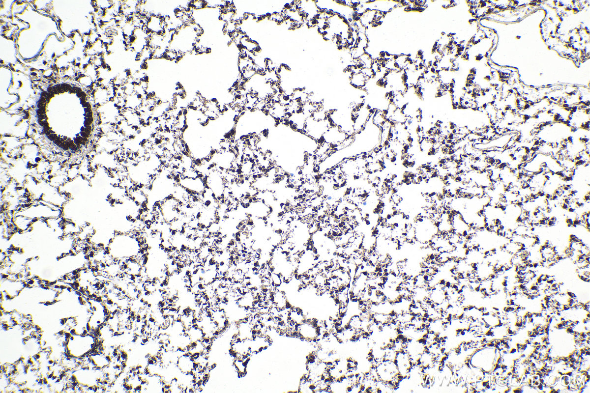 Immunohistochemical analysis of paraffin-embedded rat lung tissue slide using KHC1933 (RGC32 IHC Kit).