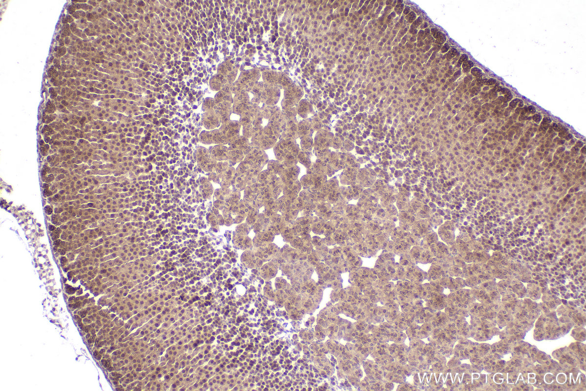 Immunohistochemical analysis of paraffin-embedded mouse adrenal gland tissue slide using KHC2258 (RGS2 IHC Kit).