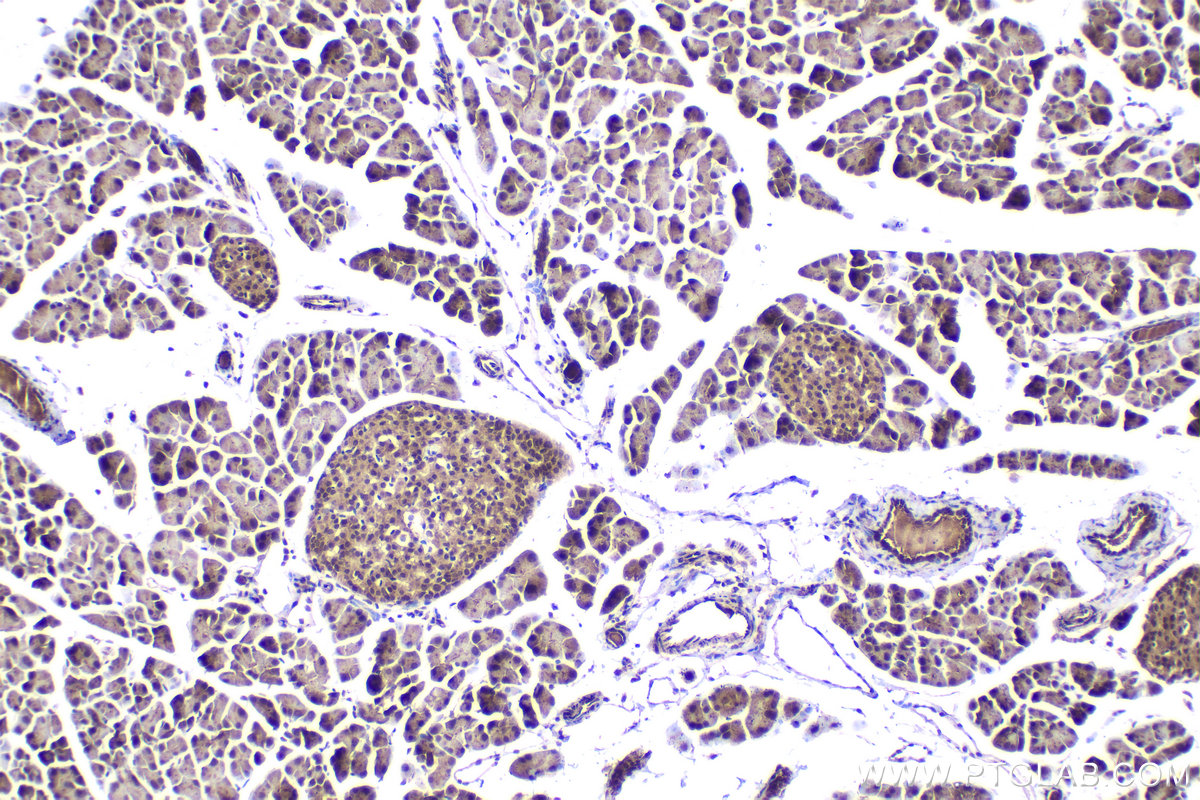 Immunohistochemical analysis of paraffin-embedded mouse pancreas tissue slide using KHC2258 (RGS2 IHC Kit).