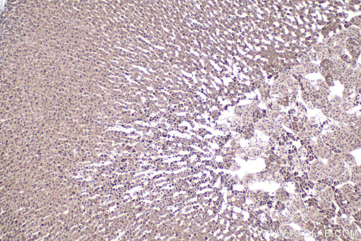 Immunohistochemical analysis of paraffin-embedded rat adrenal gland tissue slide using KHC2258 (RGS2 IHC Kit).