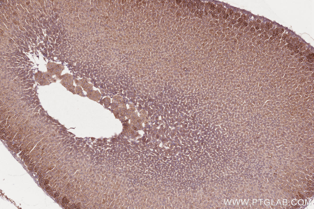 Immunohistochemical analysis of paraffin-embedded mouse adrenal gland tissue slide using KHC2594 (RICTOR IHC Kit).