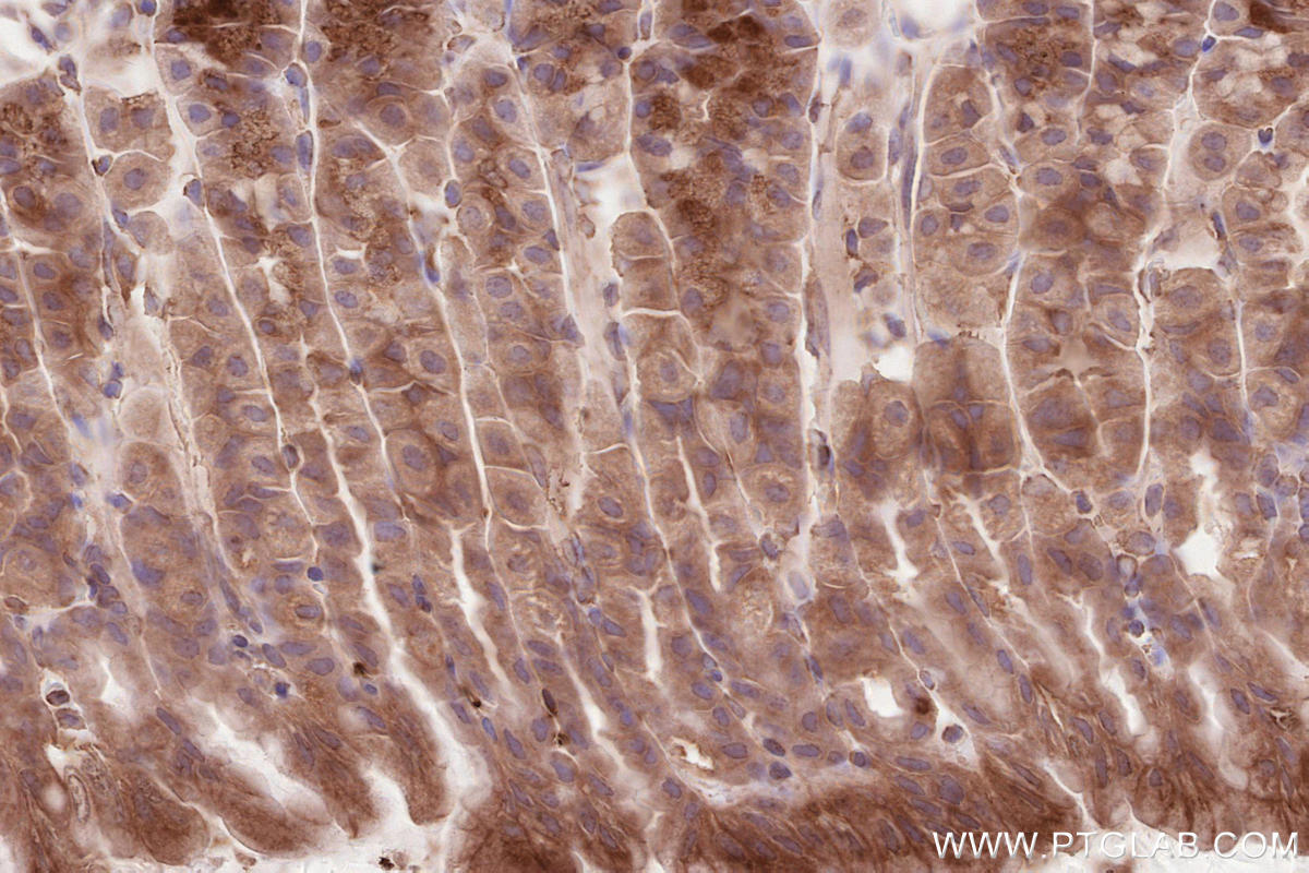 Immunohistochemical analysis of paraffin-embedded mouse stomach tissue slide using KHC2594 (RICTOR IHC Kit).