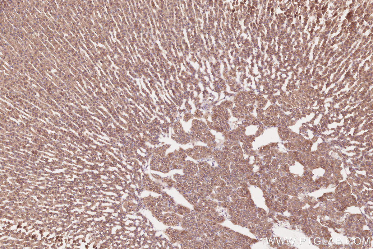 Immunohistochemical analysis of paraffin-embedded rat adrenal gland tissue slide using KHC2594 (RICTOR IHC Kit).