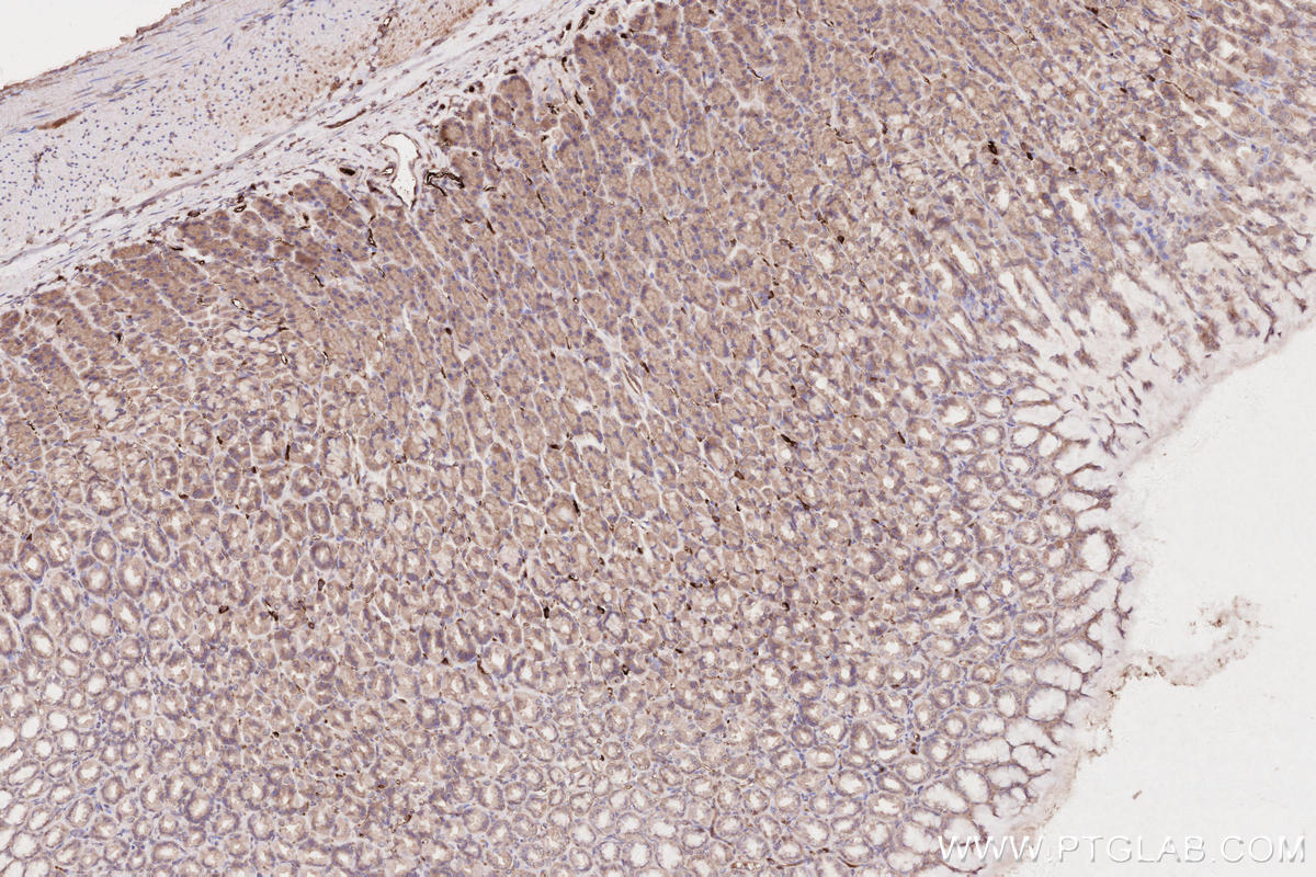 Immunohistochemical analysis of paraffin-embedded rat stomach tissue slide using KHC2594 (RICTOR IHC Kit).