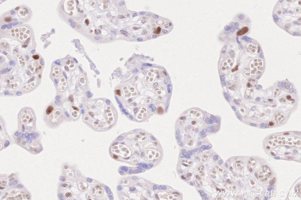 Immunohistochemical analysis of paraffin-embedded human placenta tissue slide using KHC2557 (RNASEH2B IHC Kit).