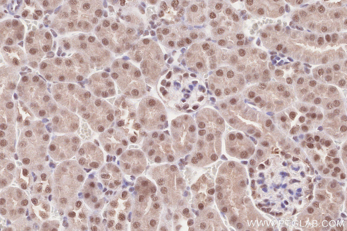 Immunohistochemical analysis of paraffin-embedded mouse kidney tissue slide using KHC2563 (RNF20 IHC Kit).