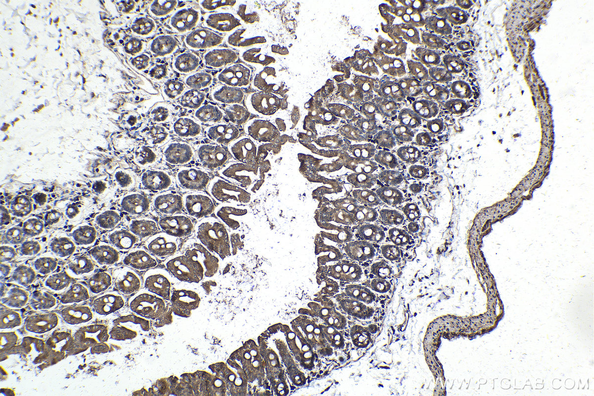 Immunohistochemical analysis of paraffin-embedded mouse small intestine tissue slide using KHC2106 (ROCK2 IHC Kit).