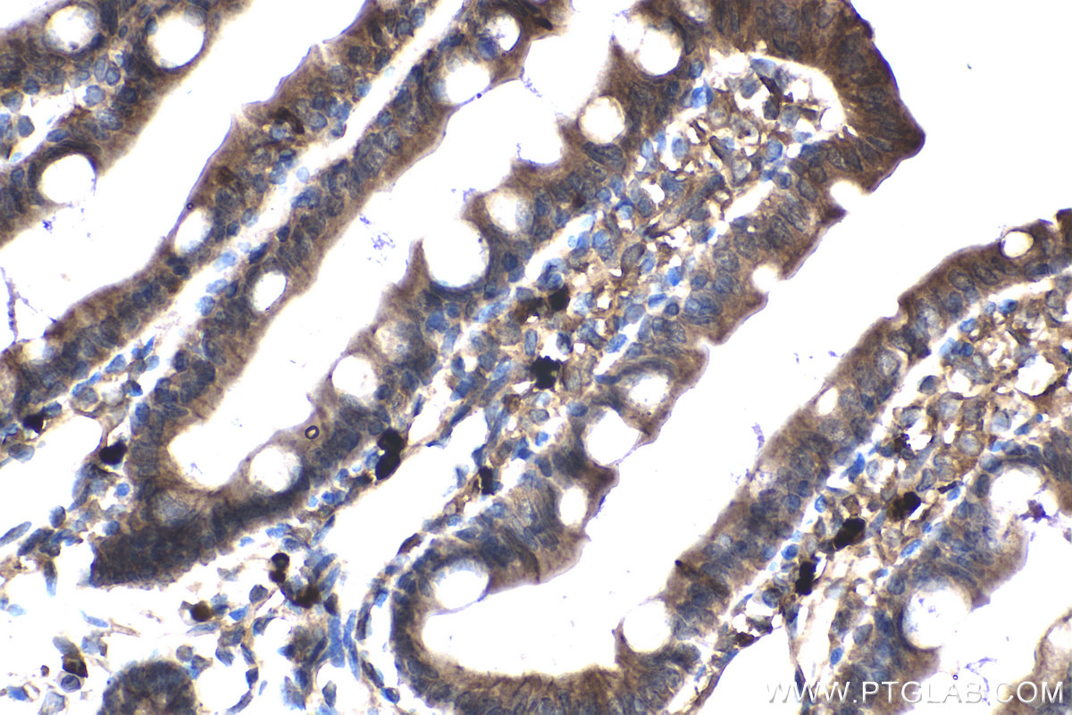 Immunohistochemical analysis of paraffin-embedded rat small intestine tissue slide using KHC2106 (ROCK2 IHC Kit).