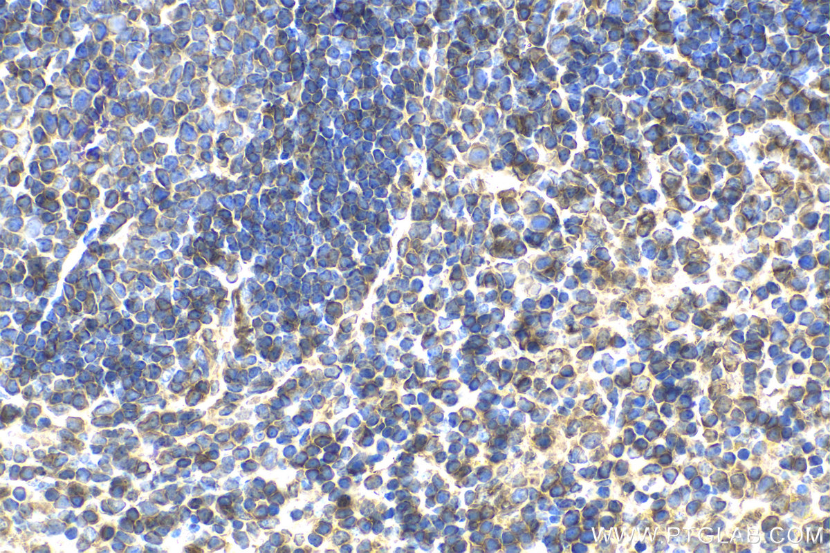 Immunohistochemical analysis of paraffin-embedded mouse spleen tissue slide using KHC2119 (RP2 IHC Kit).