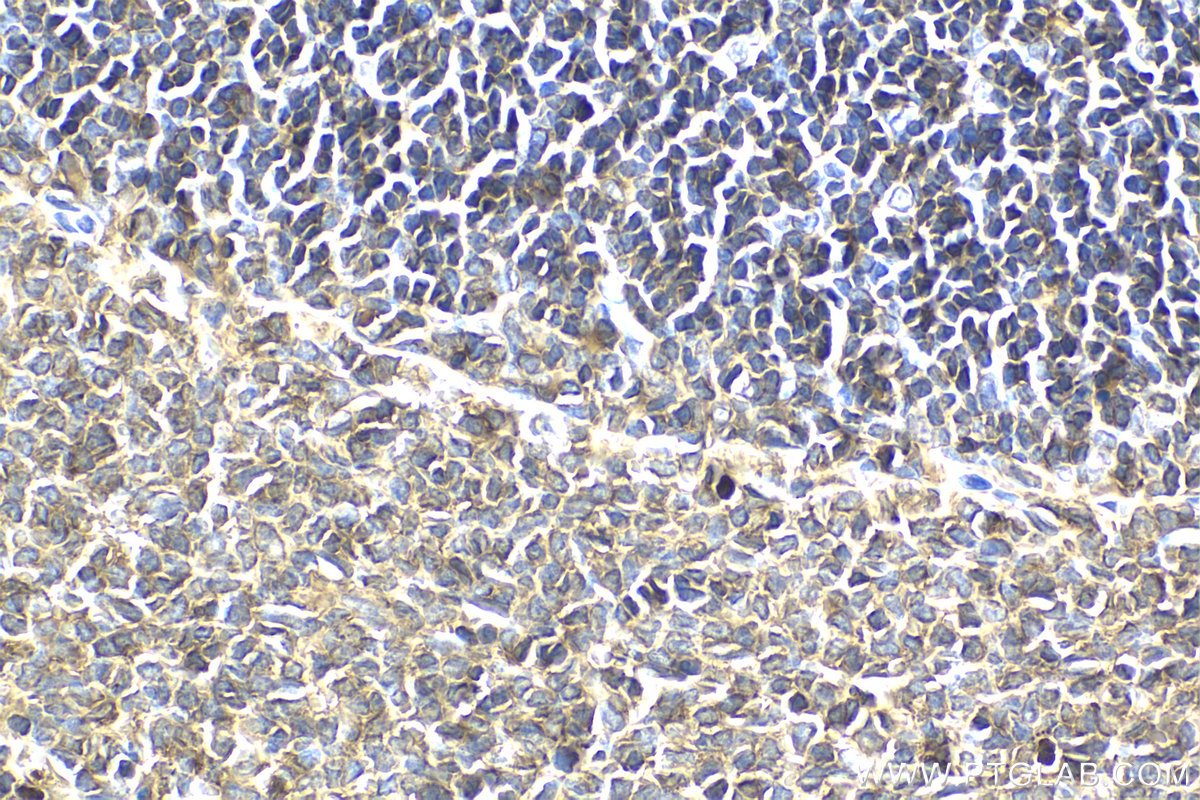 Immunohistochemical analysis of paraffin-embedded rat spleen tissue slide using KHC2119 (RP2 IHC Kit).