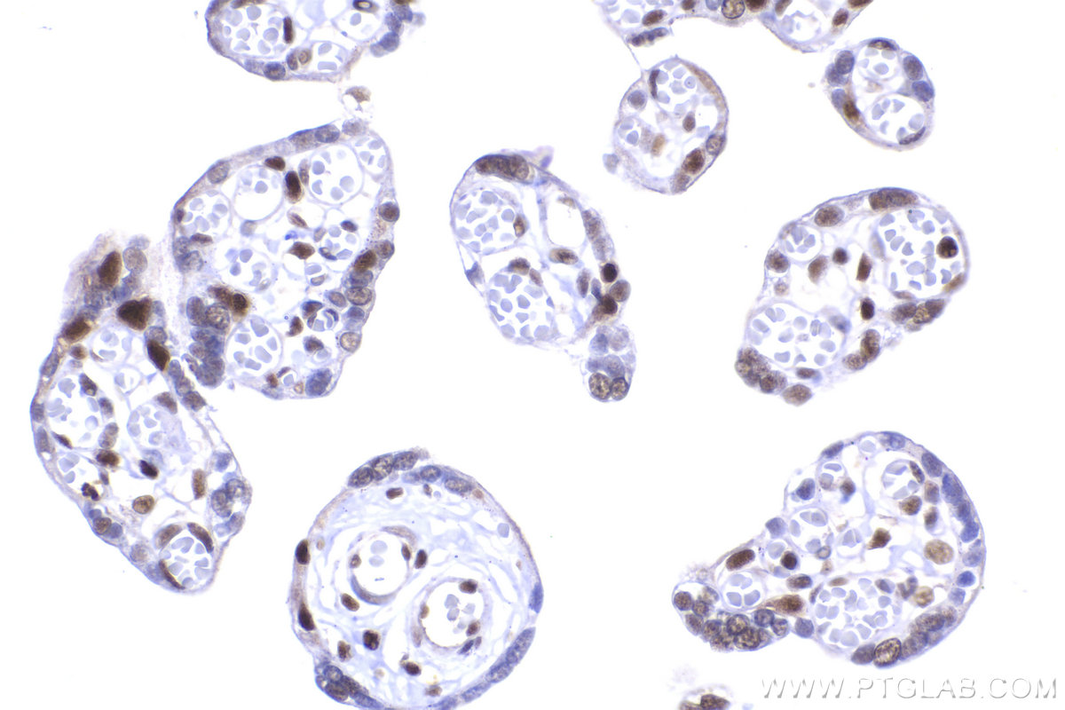 Immunohistochemical analysis of paraffin-embedded human placenta tissue slide using KHC2246 (RPA3 IHC Kit).