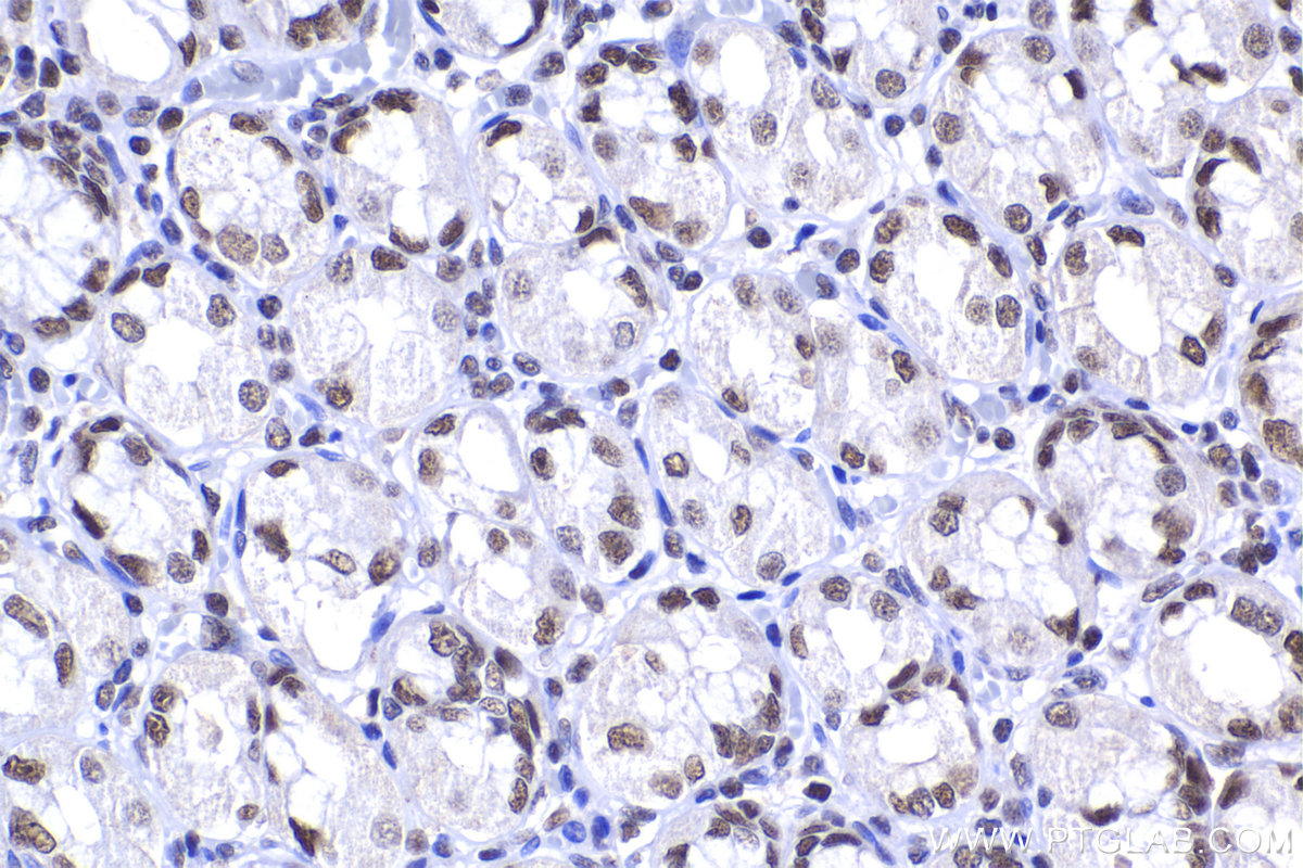 Immunohistochemical analysis of paraffin-embedded human stomach tissue slide using KHC2246 (RPA3 IHC Kit).