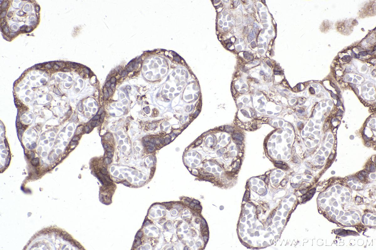 Immunohistochemical analysis of paraffin-embedded human placenta tissue slide using KHC2354 (RPL11 IHC Kit).