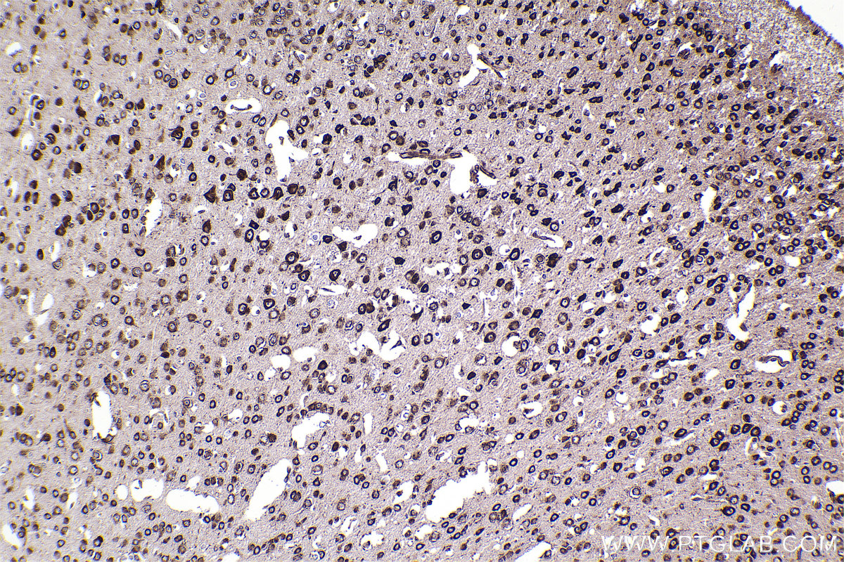 Immunohistochemical analysis of paraffin-embedded mouse brain tissue slide using KHC2354 (RPL11 IHC Kit).