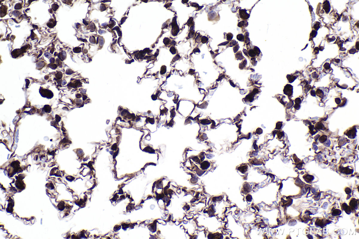 Immunohistochemical analysis of paraffin-embedded mouse lung tissue slide using KHC2354 (RPL11 IHC Kit).