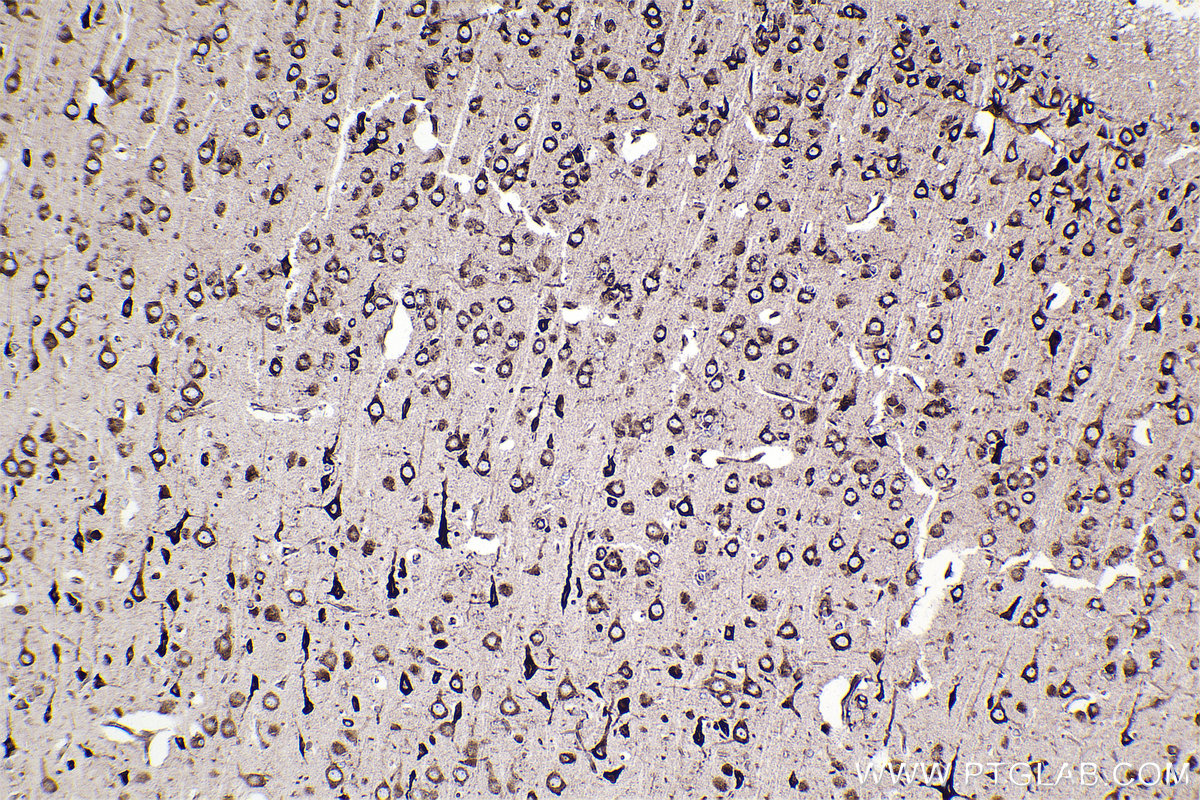 Immunohistochemical analysis of paraffin-embedded rat brain tissue slide using KHC2354 (RPL11 IHC Kit).