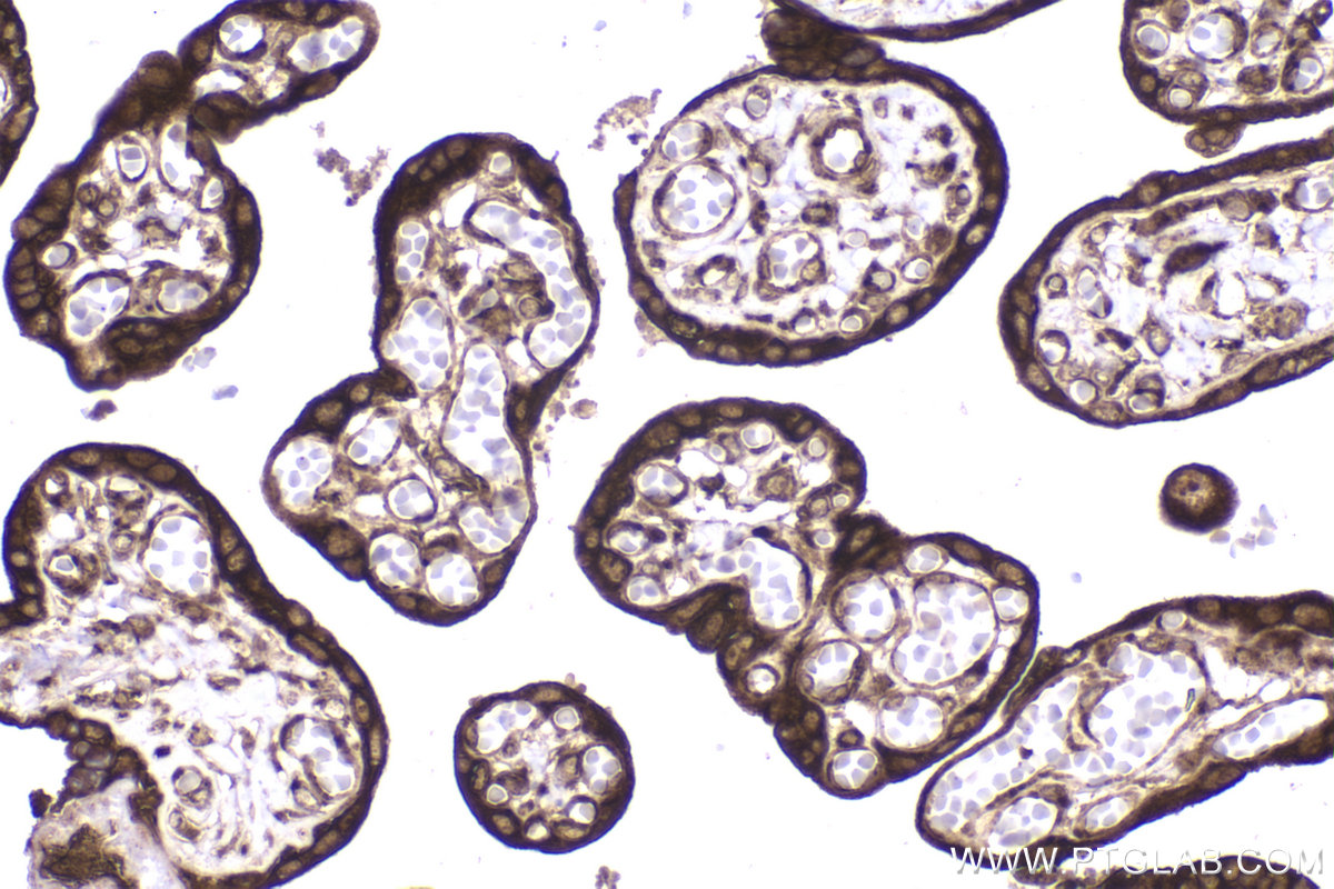 Immunohistochemical analysis of paraffin-embedded human placenta tissue slide using KHC2253 (RPL4 IHC Kit).