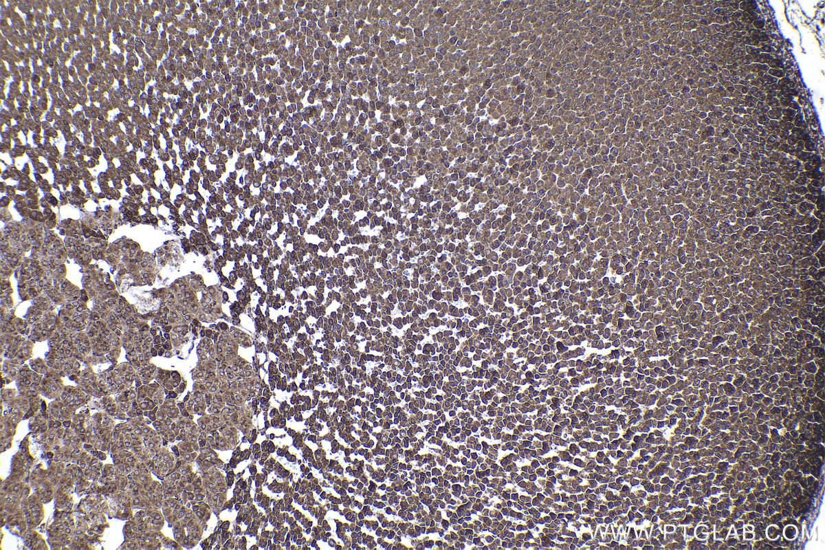 Immunohistochemical analysis of paraffin-embedded rat adrenal gland tissue slide using KHC2253 (RPL4 IHC Kit).