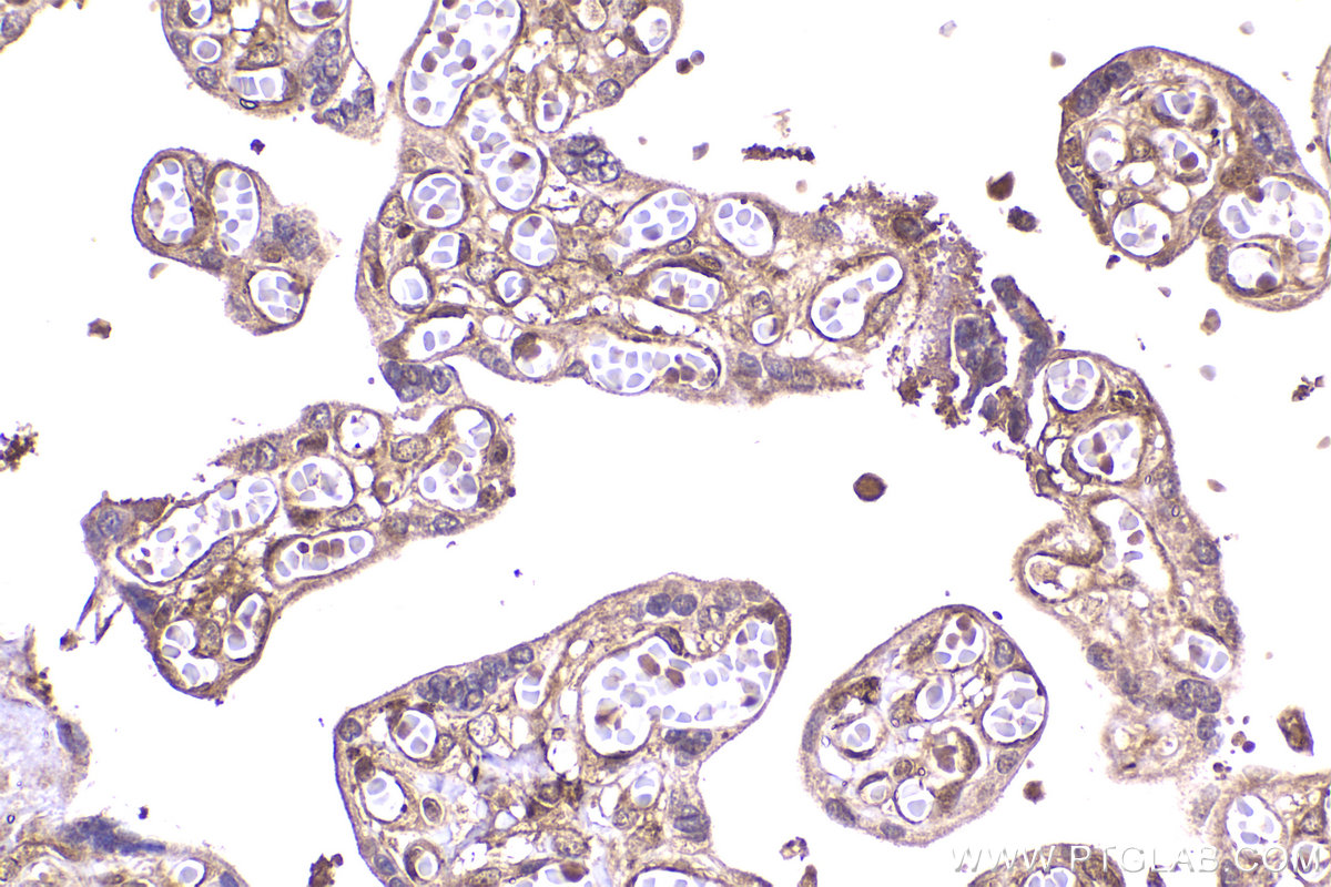 Immunohistochemical analysis of paraffin-embedded human placenta tissue slide using KHC2279 (RPS9 IHC Kit).