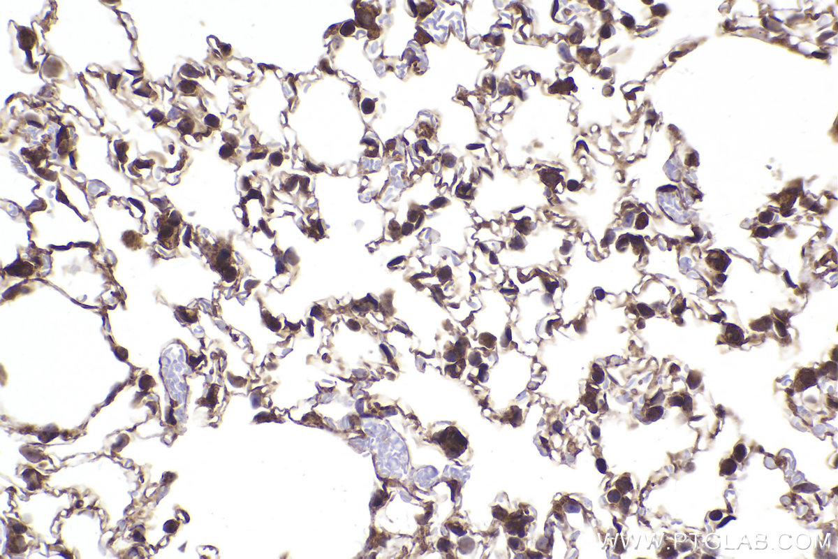 Immunohistochemical analysis of paraffin-embedded mouse lung tissue slide using KHC2279 (RPS9 IHC Kit).