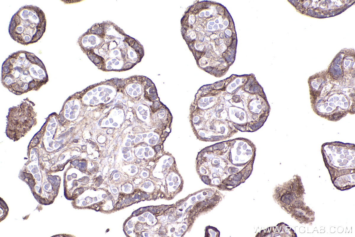 Immunohistochemical analysis of paraffin-embedded human placenta tissue slide using KHC2344 (RRAS2 IHC Kit).