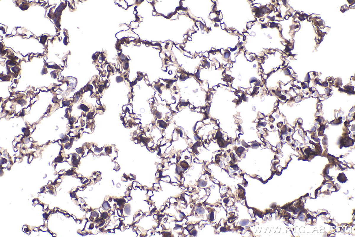 Immunohistochemical analysis of paraffin-embedded mouse lung tissue slide using KHC2344 (RRAS2 IHC Kit).