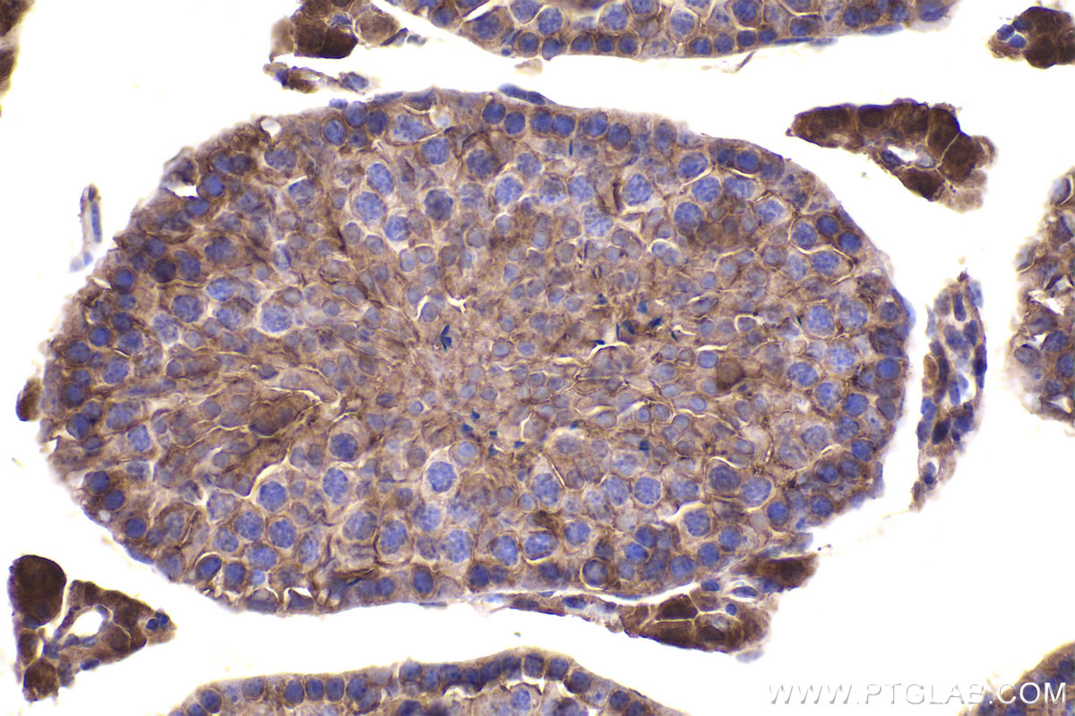 Immunohistochemical analysis of paraffin-embedded mouse testis tissue slide using KHC2344 (RRAS2 IHC Kit).