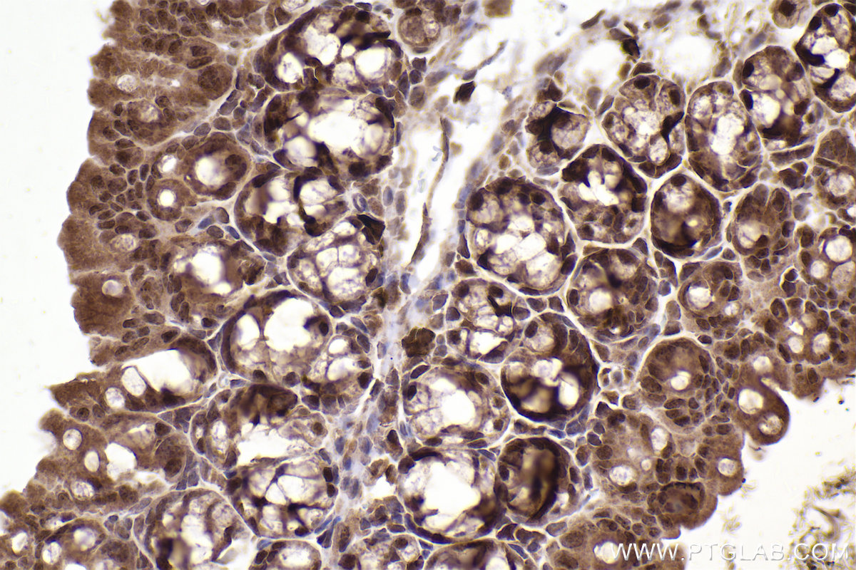 Immunohistochemical analysis of paraffin-embedded mouse small intestine tissue slide using KHC2233 (RRM2 IHC Kit).