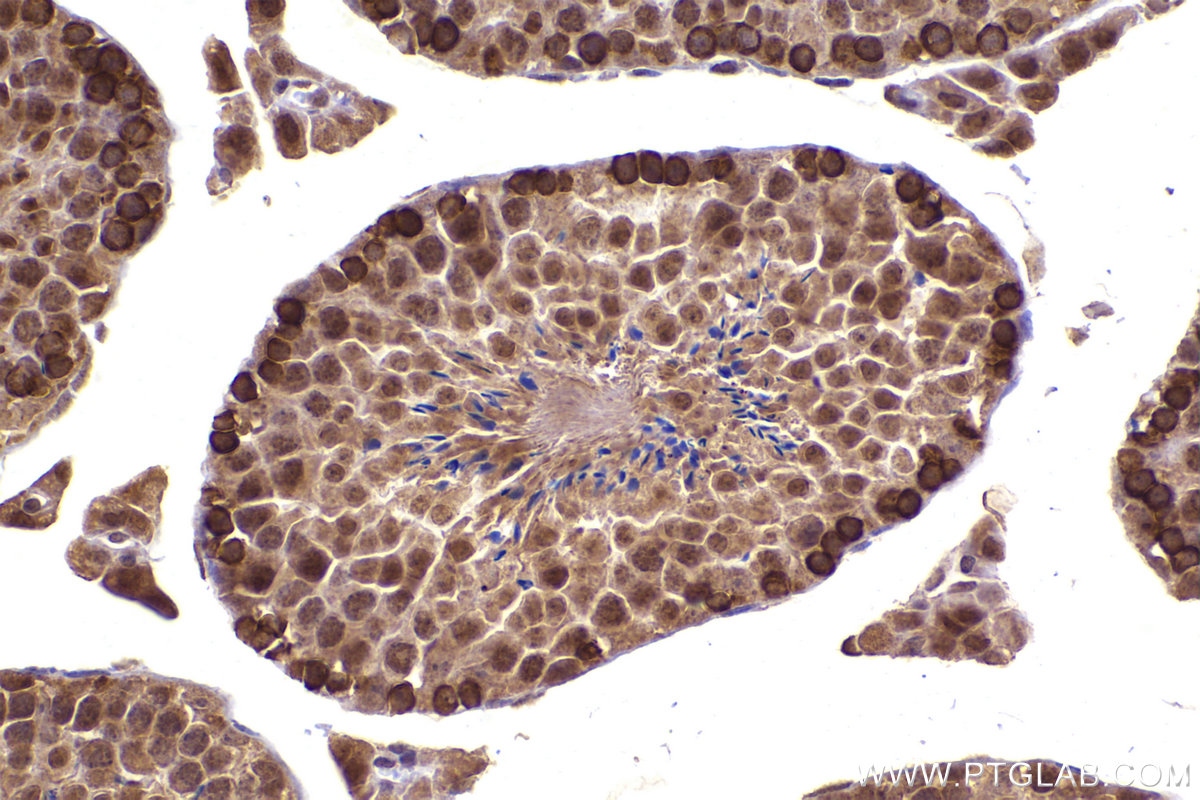 Immunohistochemical analysis of paraffin-embedded mouse testis tissue slide using KHC2233 (RRM2 IHC Kit).