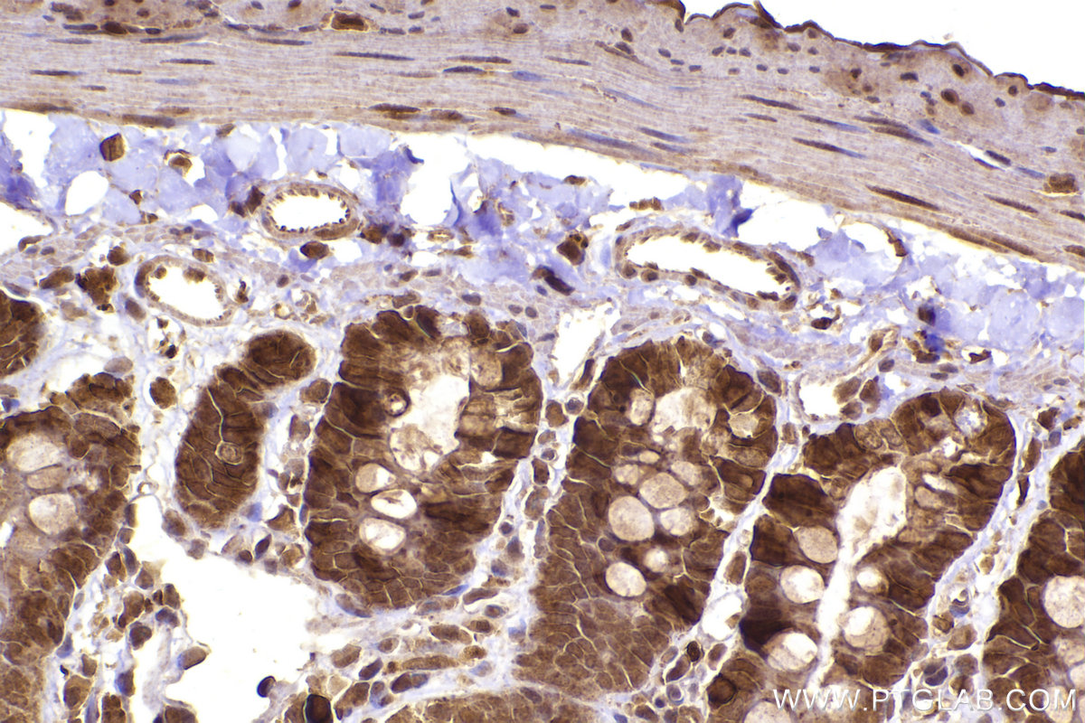 Immunohistochemical analysis of paraffin-embedded rat small intestine tissue slide using KHC2233 (RRM2 IHC Kit).