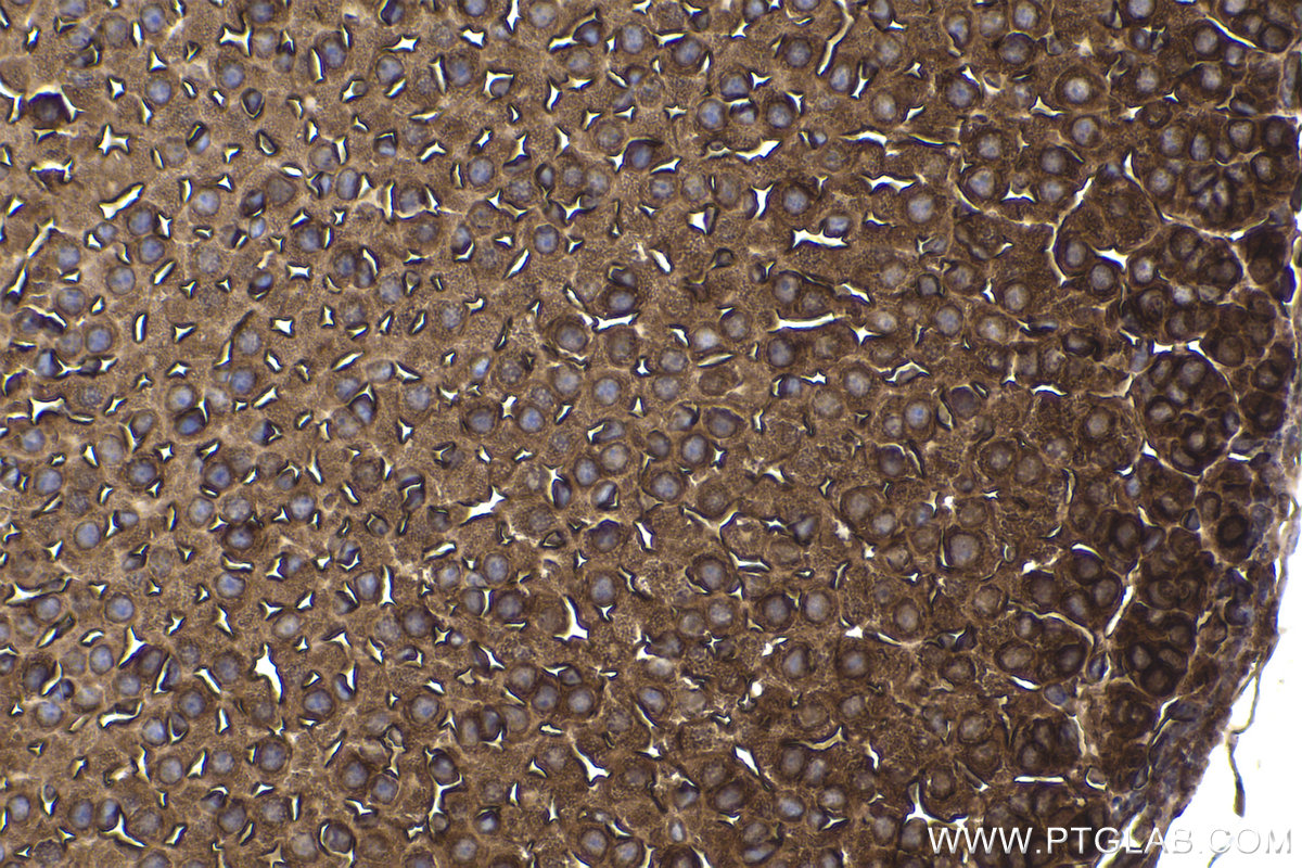 Immunohistochemical analysis of paraffin-embedded mouse adrenal gland tissue slide using KHC2245 (Radixin/RDX IHC Kit).