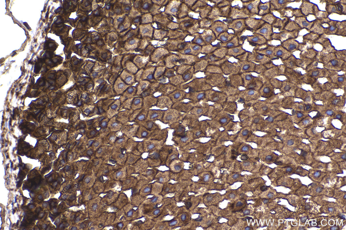 Immunohistochemical analysis of paraffin-embedded rat adrenal gland tissue slide using KHC2245 (Radixin/RDX IHC Kit).