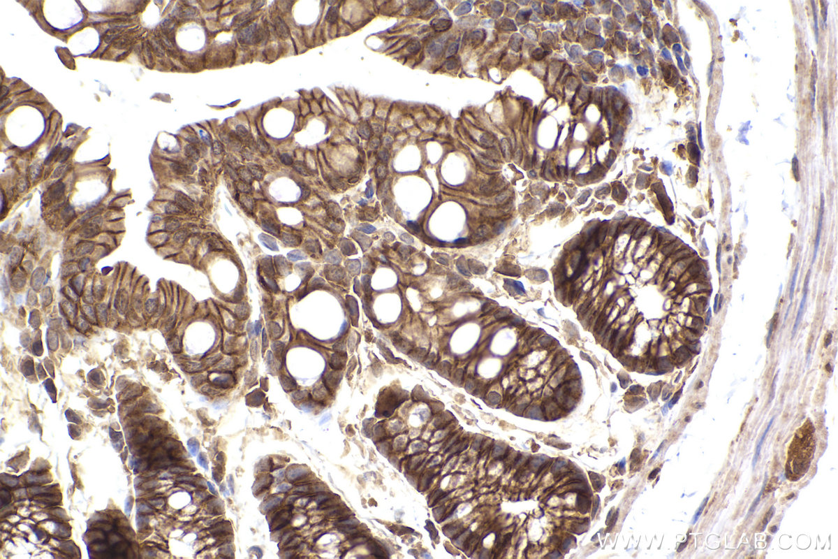 Immunohistochemical analysis of paraffin-embedded mouse colon tissue slide using KHC2450 (SCRIB IHC Kit).