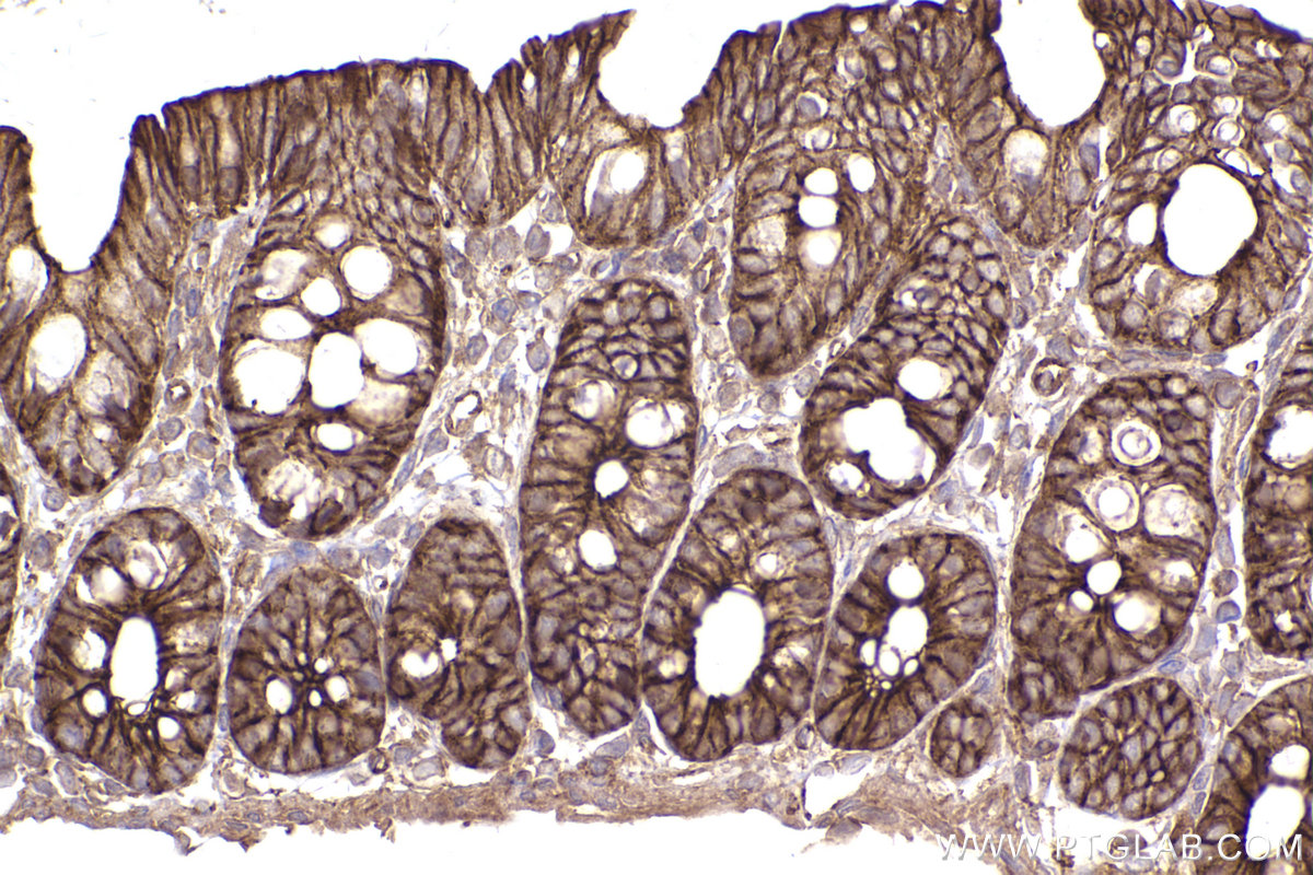 Immunohistochemical analysis of paraffin-embedded rat colon tissue slide using KHC2450 (SCRIB IHC Kit).