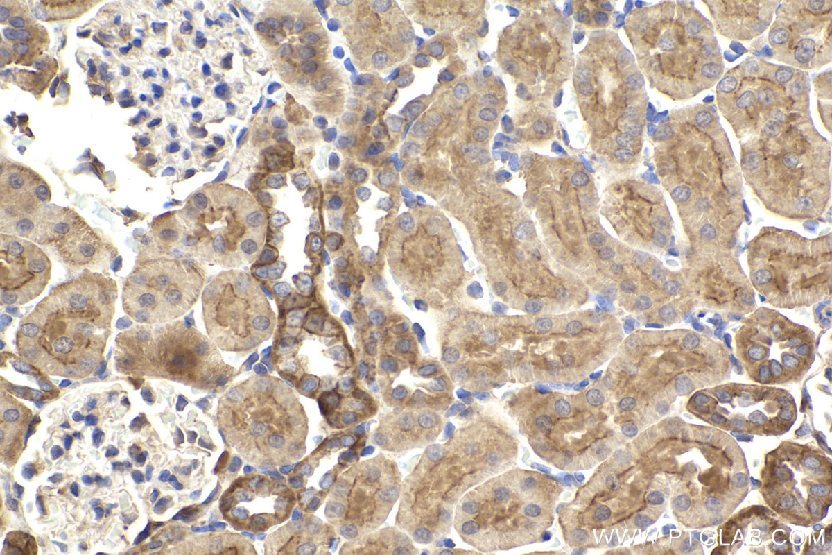 Immunohistochemical analysis of paraffin-embedded rat kidney tissue slide using KHC2450 (SCRIB IHC Kit).