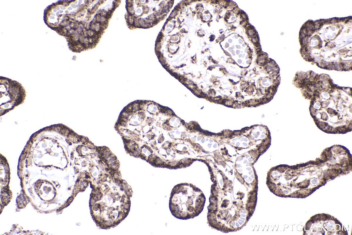 Immunohistochemical analysis of paraffin-embedded human placenta tissue slide using KHC2231 (SDHA IHC Kit).