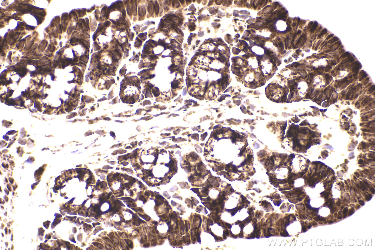 Immunohistochemical analysis of paraffin-embedded mouse small intestine tissue slide using KHC2231 (SDHA IHC Kit).