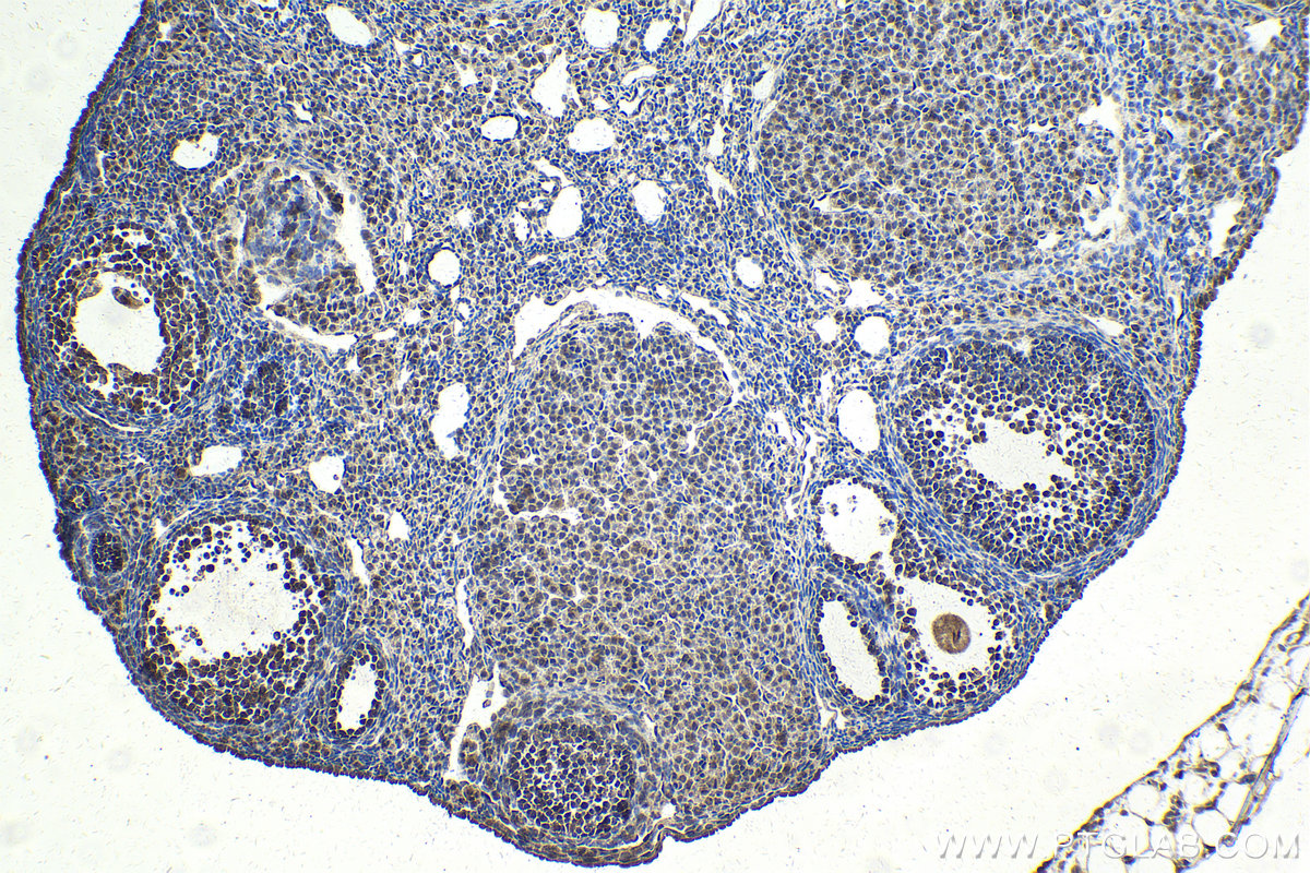 Immunohistochemical analysis of paraffin-embedded mouse ovary tissue slide using KHC2147 (SDPR IHC Kit).