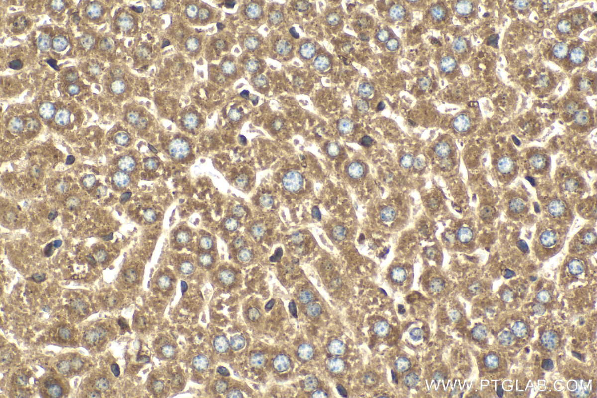 Immunohistochemical analysis of paraffin-embedded mouse liver tissue slide using KHC2112 (SEC22B IHC Kit).