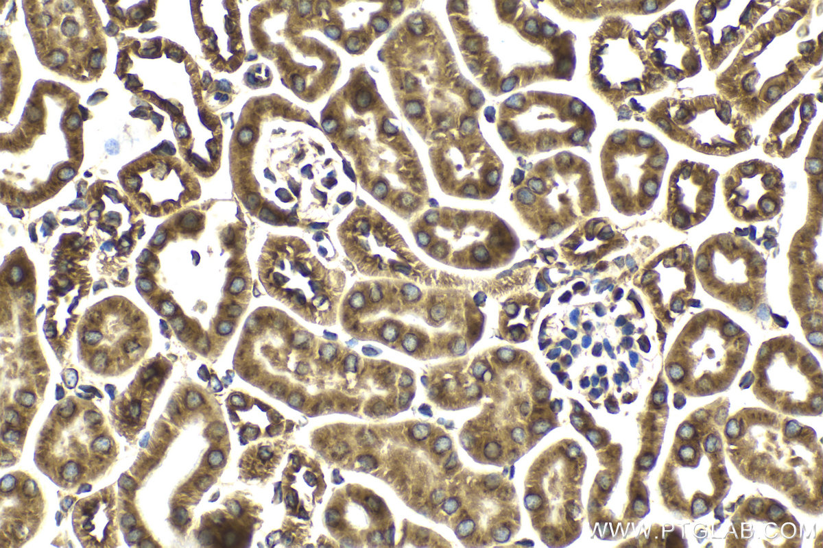 Immunohistochemical analysis of paraffin-embedded mouse kidney tissue slide using KHC2112 (SEC22B IHC Kit).