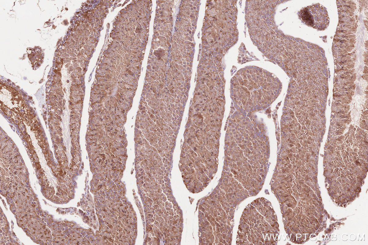 Immunohistochemical analysis of paraffin-embedded mouse testis tissue slide using KHC2606 (SEPT14 IHC Kit).