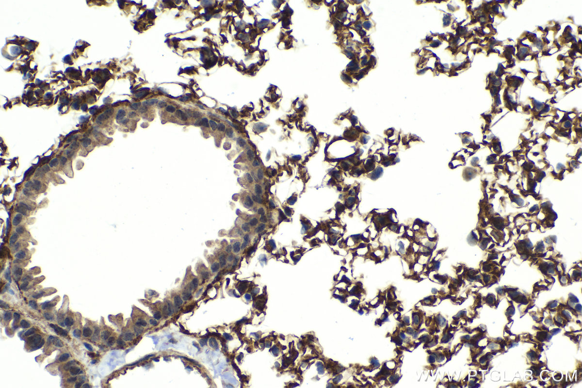 Immunohistochemical analysis of paraffin-embedded mouse lung tissue slide using KHC2073 (SEPT4 IHC Kit).