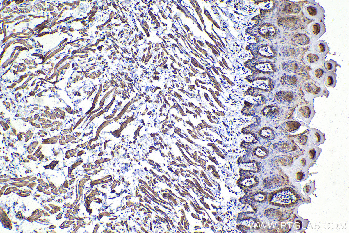 Immunohistochemical analysis of paraffin-embedded rat tongue tissue slide using KHC2194 (ATP2A2 IHC Kit).