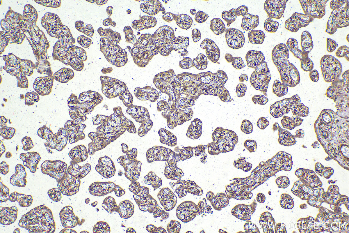 Immunohistochemical analysis of paraffin-embedded human placenta tissue slide using KHC2194 (ATP2A2 IHC Kit).