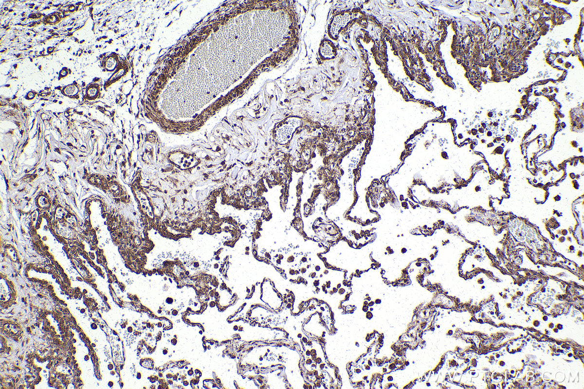 Immunohistochemical analysis of paraffin-embedded human lung tissue slide using KHC2194 (ATP2A2 IHC Kit).