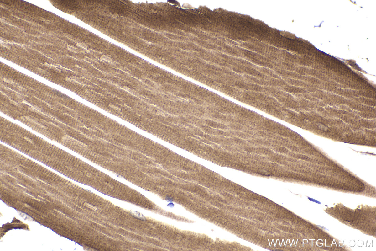 Immunohistochemical analysis of paraffin-embedded mouse skeletal muscle tissue slide using KHC2194 (ATP2A2 IHC Kit).